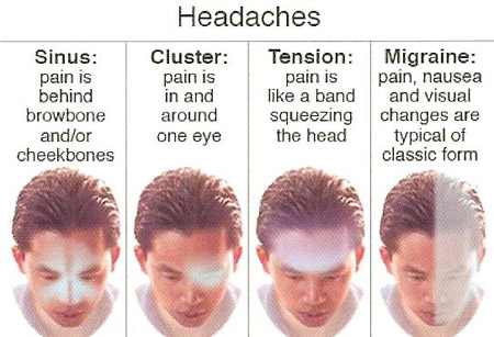 neuro-headaches-2